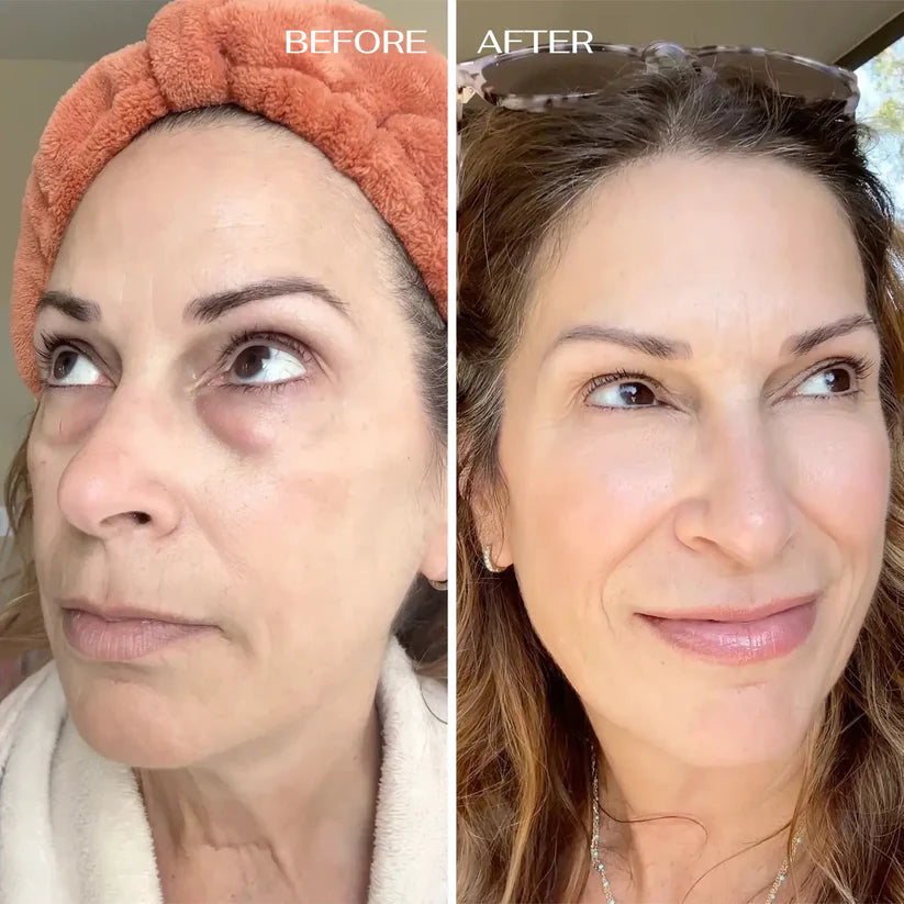 All-In-One Balm For Under-eye Renewal