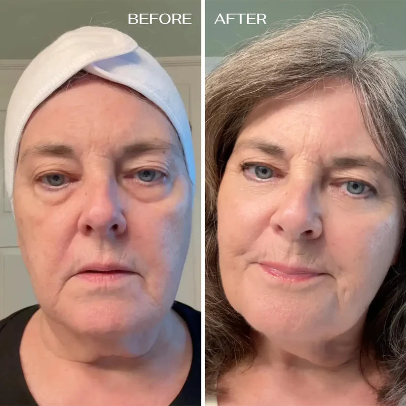 All-In-One Balm For Under-eye Renewal